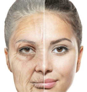 anti-aging cilt bakımı