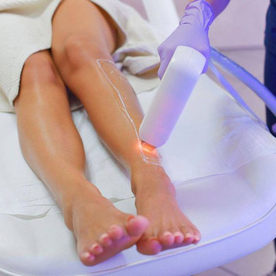 Lazer Epilasyon: Uzun Süreli Pürüzsüz Güzellik