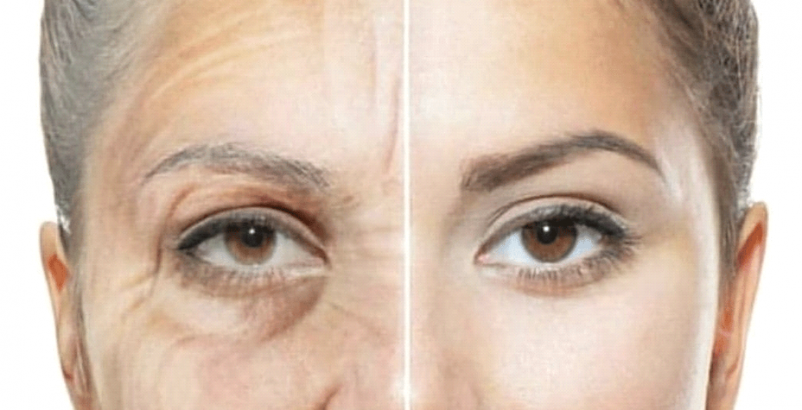 anti-aging cilt bakımı